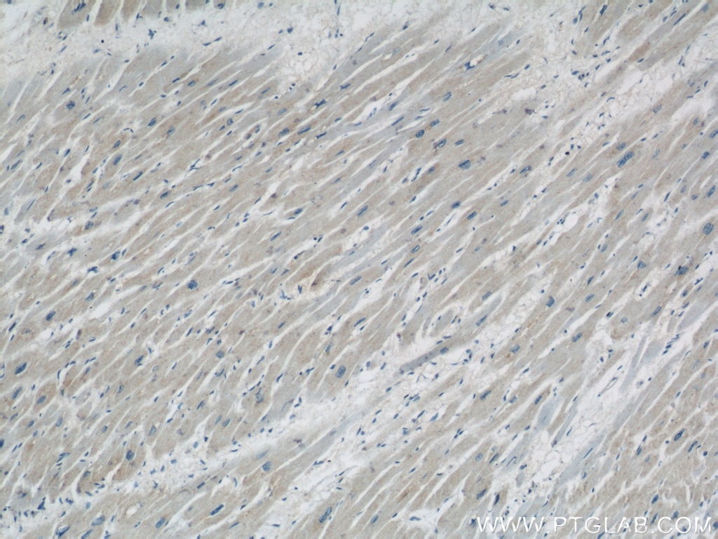 Immunohistochemistry (IHC) staining of human heart tissue using COXIV Monoclonal antibody (60251-1-Ig)