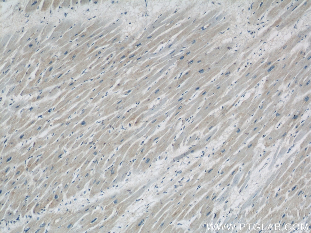 IHC staining of human heart using 60251-1-Ig