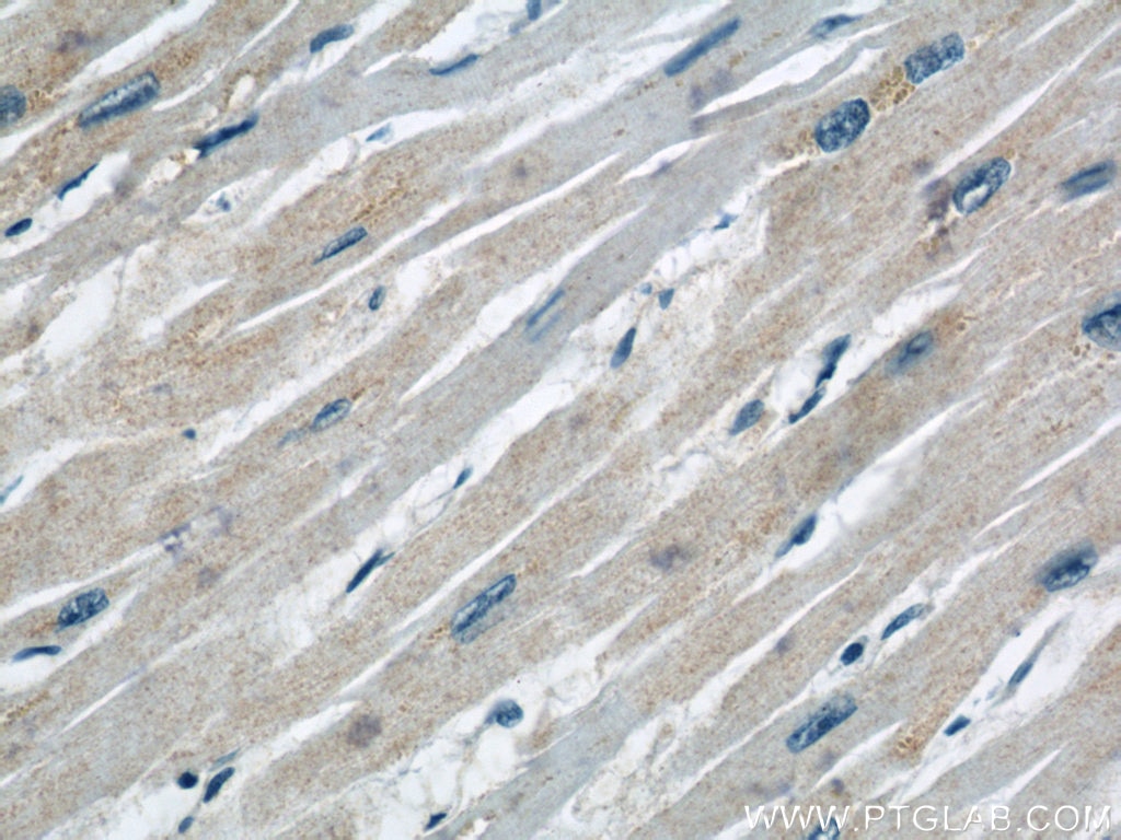 IHC staining of human heart using 60251-1-Ig