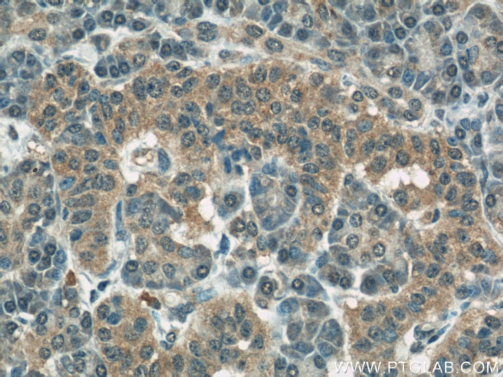 IHC staining of human pancreas using 66110-1-Ig