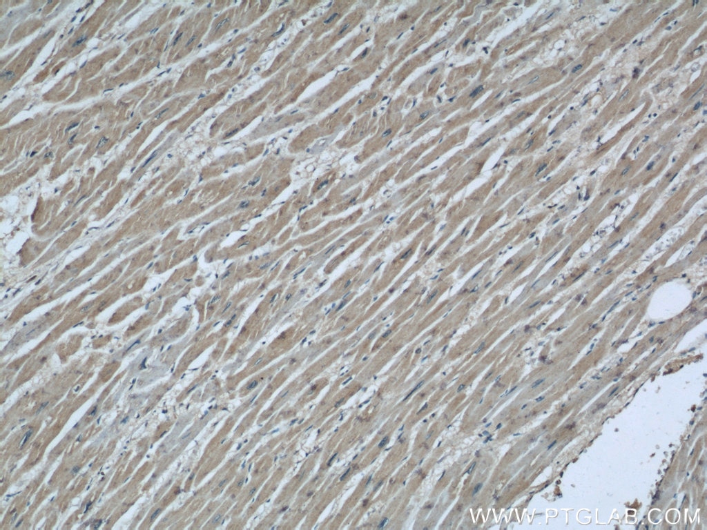 Immunohistochemistry (IHC) staining of human heart tissue using COXIV Monoclonal antibody (66110-1-Ig)
