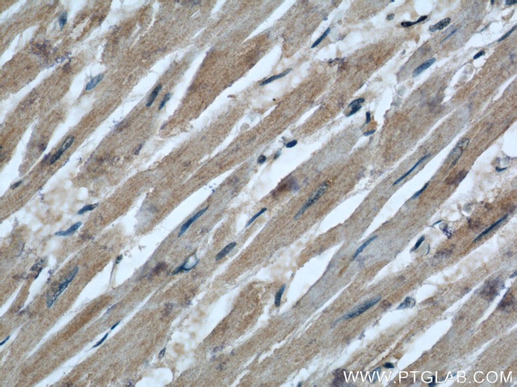 IHC staining of human heart using 66110-1-Ig