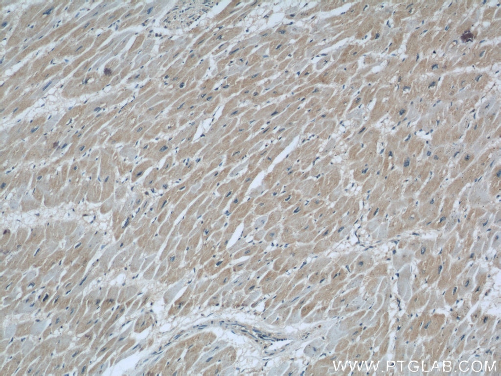 IHC staining of human heart using 66110-1-Ig