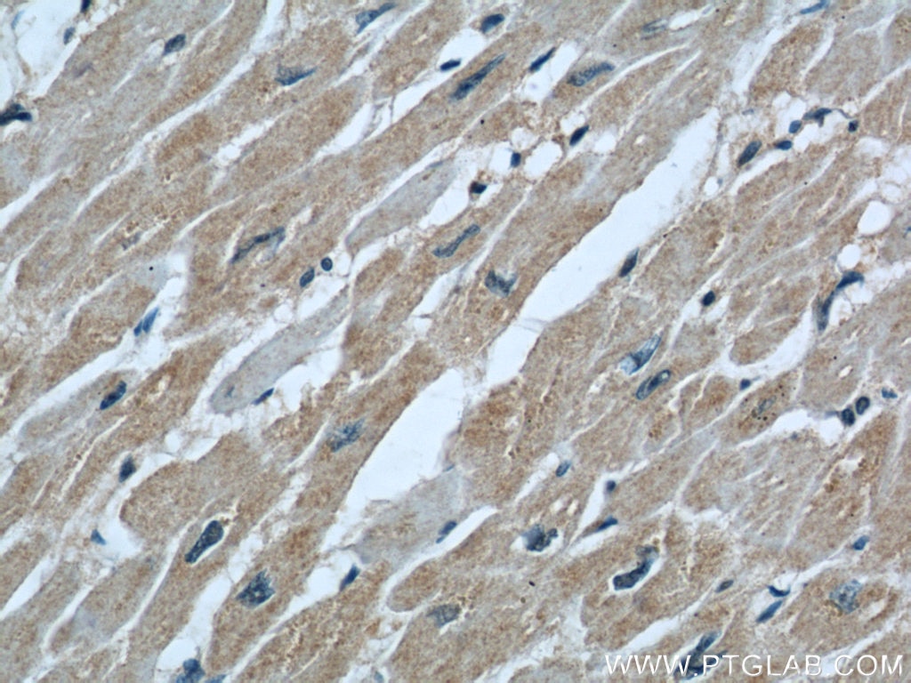 Immunohistochemistry (IHC) staining of human heart tissue using COXIV Monoclonal antibody (66110-1-Ig)