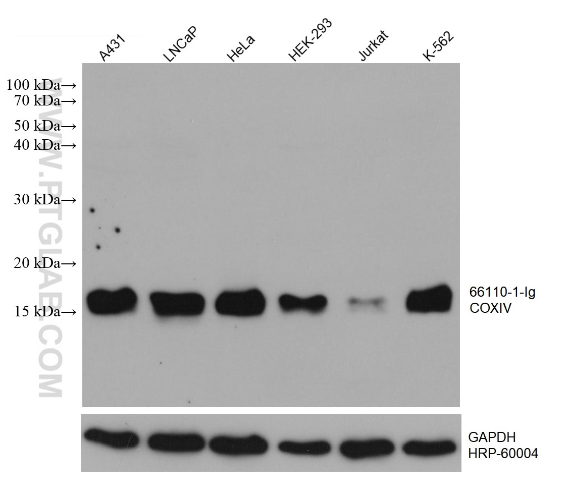 WB analysis using 66110-1-Ig