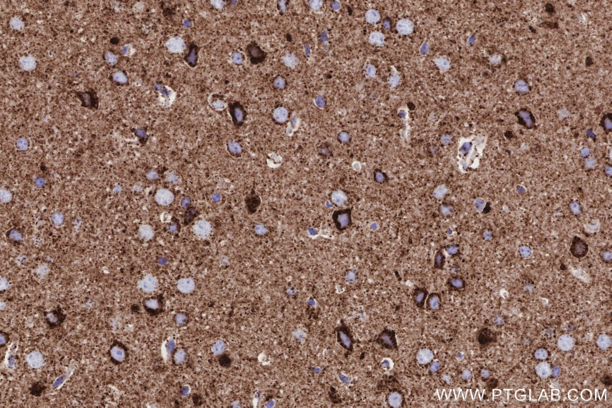 IHC staining of mouse brain using 82916-1-RR Immunohistochemistry (IHC) staining of mouse brain tissue using COXIV Recombinant monoclonal antibody (82916-1-RR)