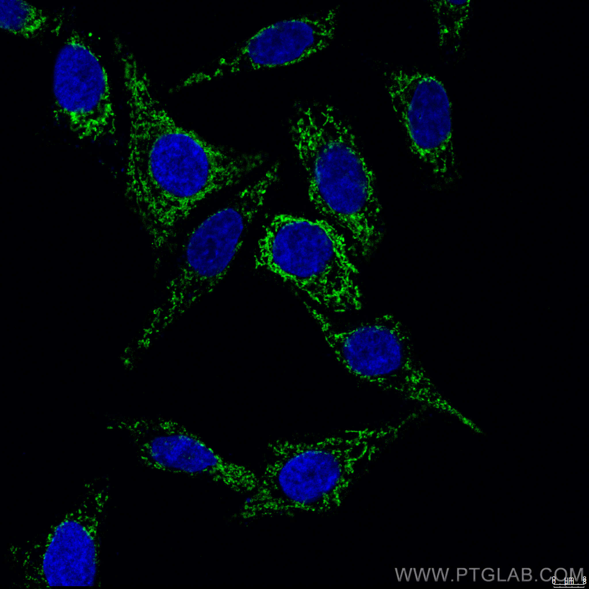 IF Staining of HepG2 using CL488-60251