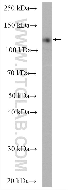 WB analysis of human plasma using 21131-1-AP