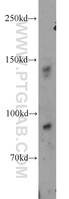 Western Blot (WB) analysis of mouse brain tissue using Ceruloplasmin Polyclonal antibody (21131-1-AP)