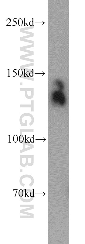 Ceruloplasmin