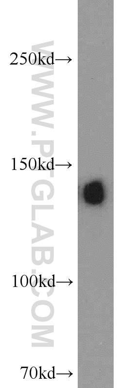 Western Blot (WB) analysis of human plasma using Ceruloplasmin Polyclonal antibody (21131-1-AP)