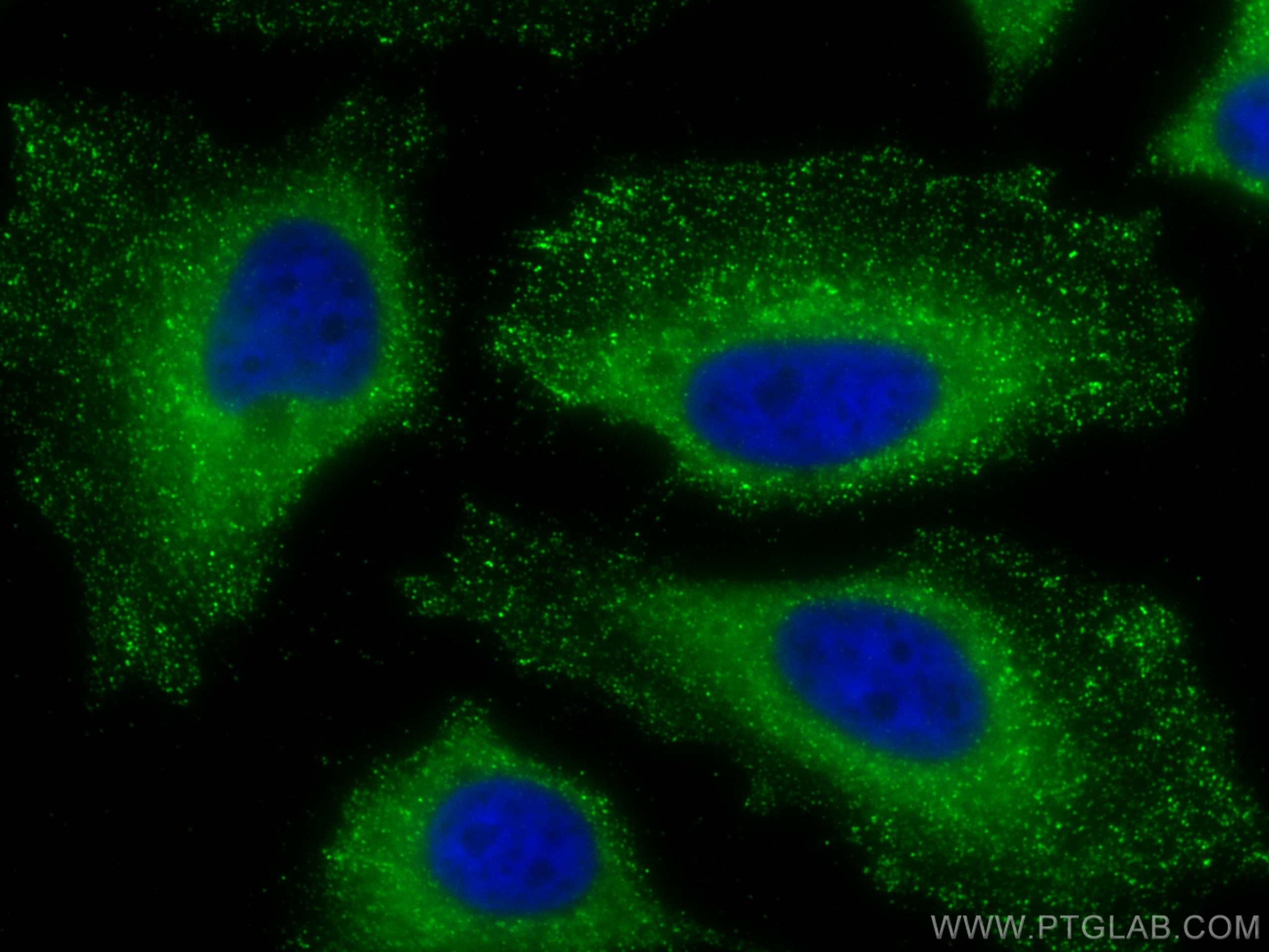 Immunofluorescence (IF) / fluorescent staining of HeLa cells using Ceruloplasmin Monoclonal antibody (66156-1-Ig)
