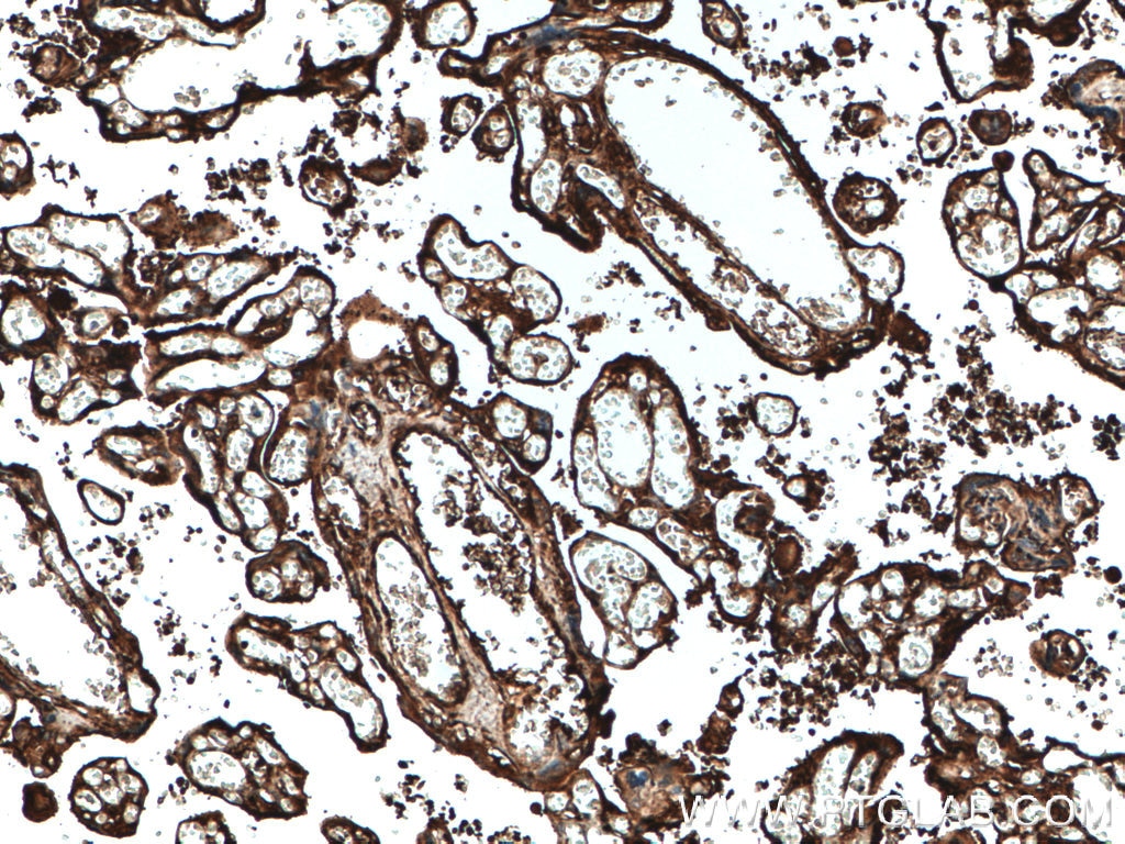 IHC staining of human placenta using 66156-1-Ig