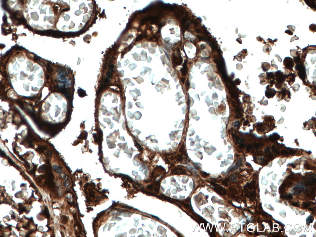 Immunohistochemistry (IHC) staining of human placenta tissue using Ceruloplasmin Monoclonal antibody (66156-1-Ig)