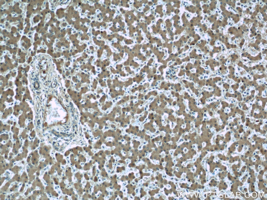 Immunohistochemistry (IHC) staining of human liver tissue using Ceruloplasmin Monoclonal antibody (66156-1-Ig)