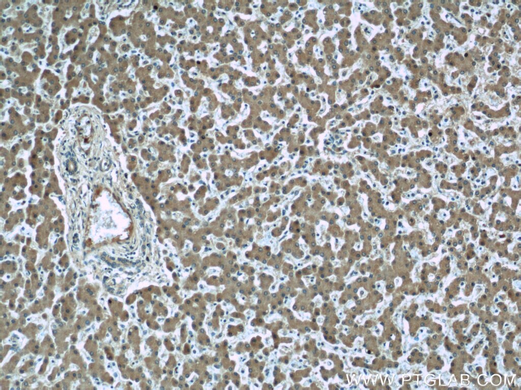 IHC staining of human liver using 66156-1-Ig