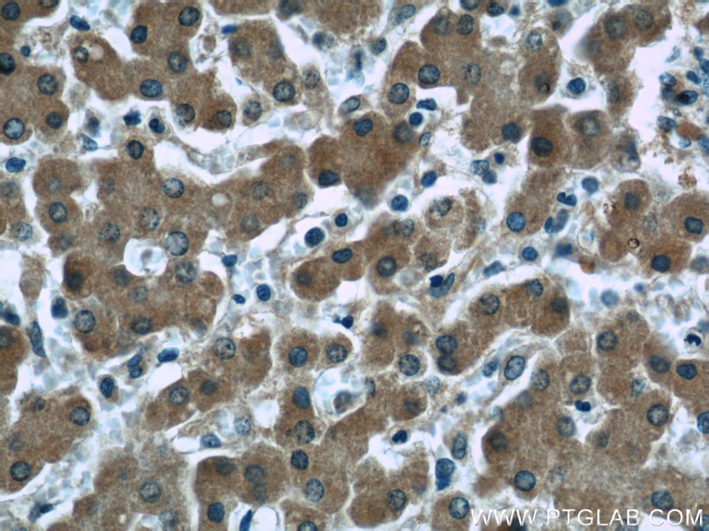 IHC staining of human liver using 66156-1-Ig
