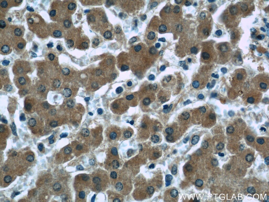 Immunohistochemistry (IHC) staining of human liver tissue using Ceruloplasmin Monoclonal antibody (66156-1-Ig)