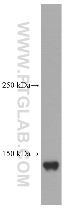 Western Blot (WB) analysis of rat liver tissue using Ceruloplasmin Monoclonal antibody (66156-1-Ig)