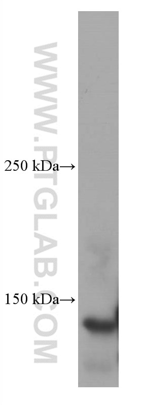 Western Blot (WB) analysis of HSC-T6 cells using Ceruloplasmin Monoclonal antibody (66156-1-Ig)