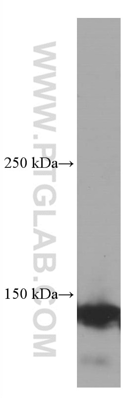 Western Blot (WB) analysis of human kidney tissue using Ceruloplasmin Monoclonal antibody (66156-1-Ig)