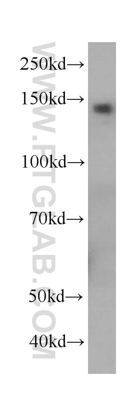 Western Blot (WB) analysis of human blood using Ceruloplasmin Monoclonal antibody (66156-1-Ig)