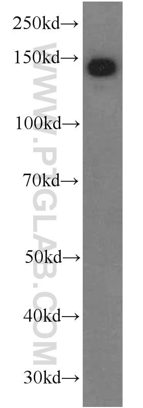 Western Blot (WB) analysis of human placenta tissue using Ceruloplasmin Monoclonal antibody (66156-1-Ig)