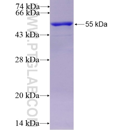 CP fusion protein Ag15535 SDS-PAGE