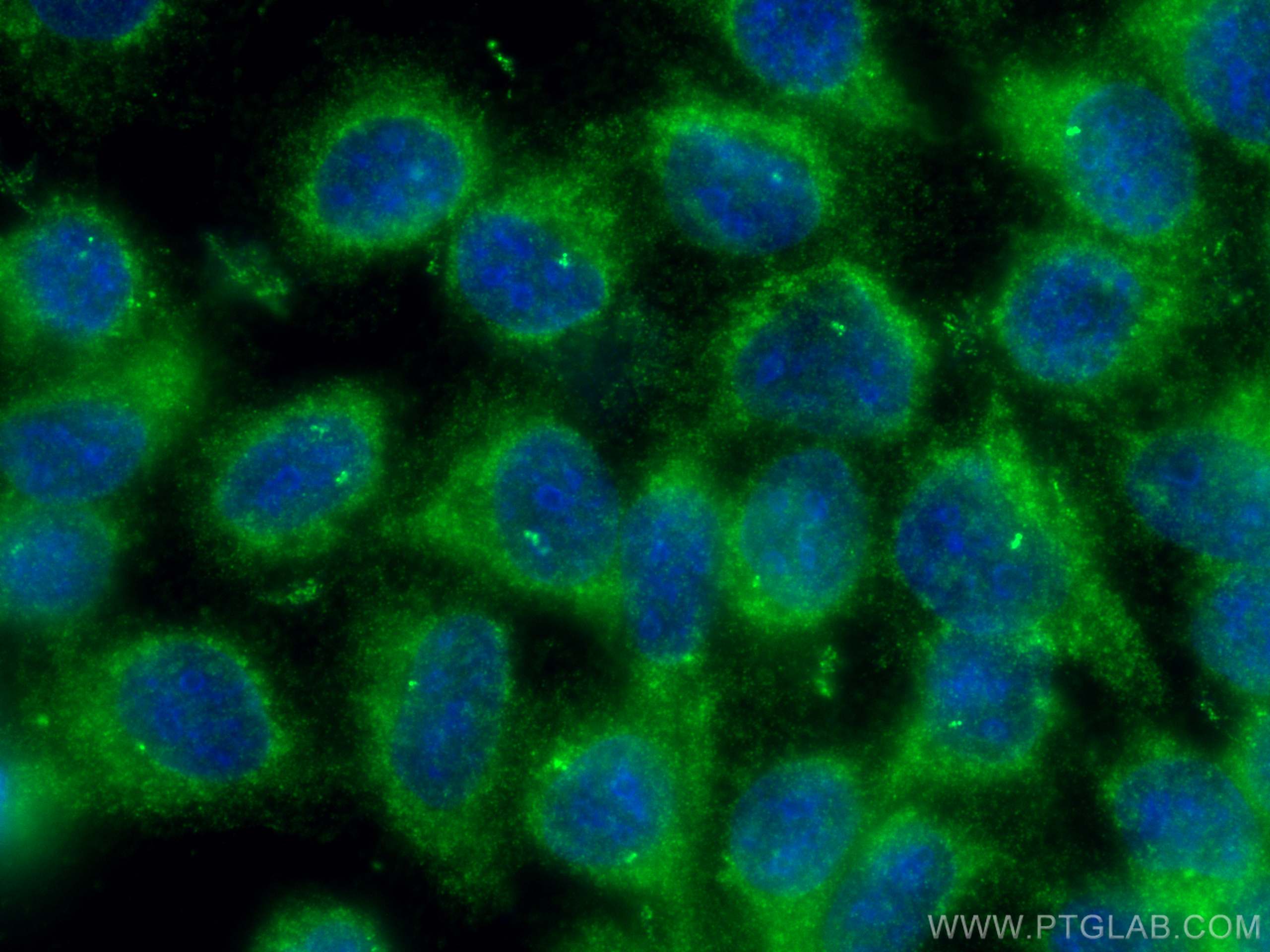 Immunofluorescence (IF) / fluorescent staining of A431 cells using CP110 Polyclonal antibody (12780-1-AP)