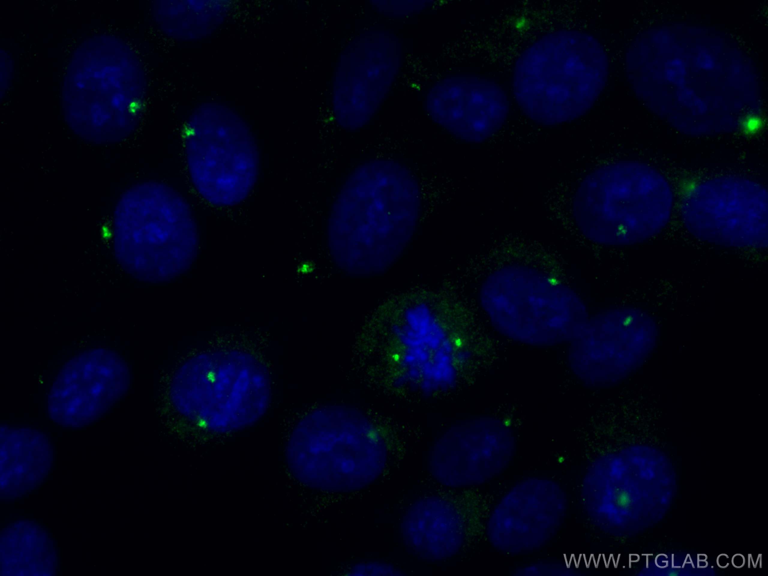 Immunofluorescence (IF) / fluorescent staining of hTERT-RPE1 cells using CP110 Polyclonal antibody (12780-1-AP)