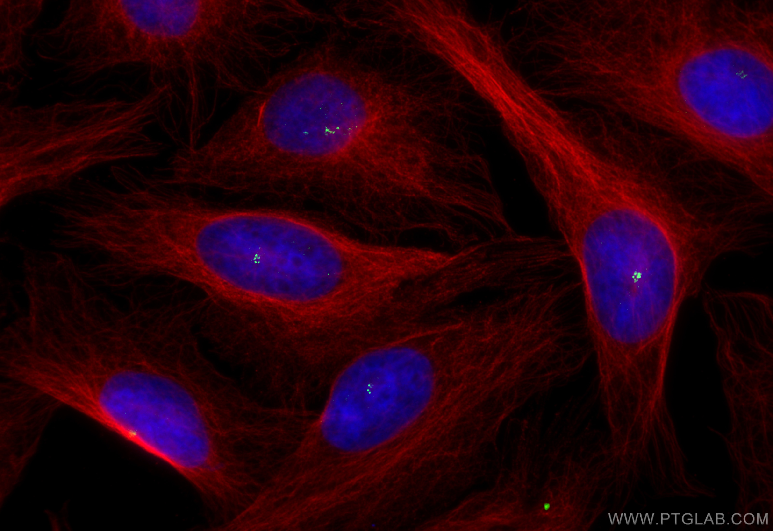 Immunofluorescence (IF) / fluorescent staining of U2OS cells using CP110 Polyclonal antibody (12780-1-AP)