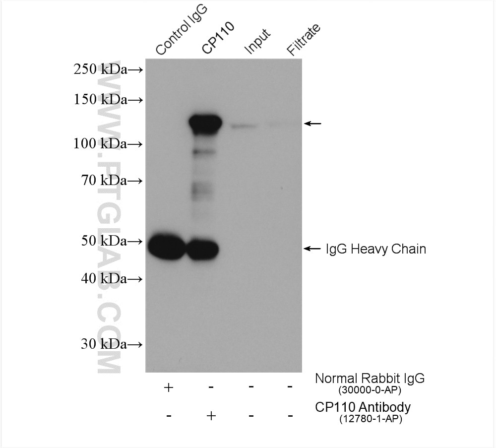 Immunoprecipitation (IP) experiment of Jurkat cells using CP110 Polyclonal antibody (12780-1-AP)