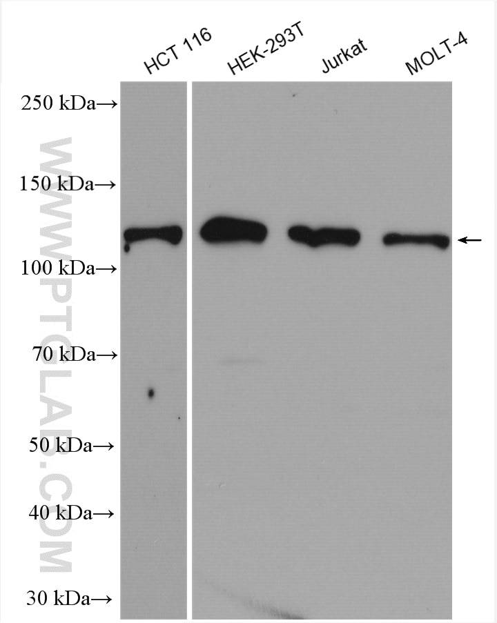 Western Blot (WB) analysis of various lysates using CP110 Polyclonal antibody (12780-1-AP)