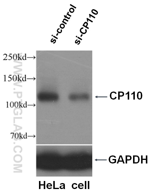 Western Blot (WB) analysis of HeLa cells using CP110 Polyclonal antibody (12780-1-AP)