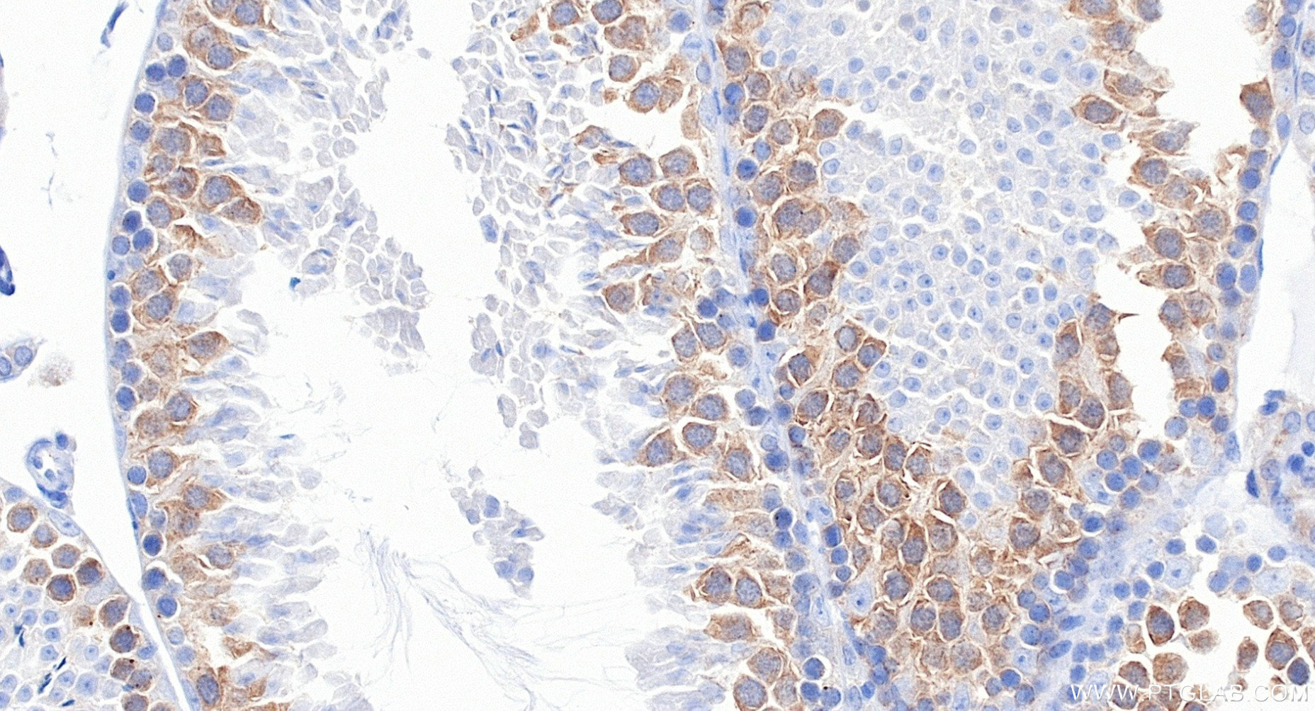 IHC staining of mouse testis using 80965-5-RR Immunohistochemistry (IHC) staining of mouse testis tissue using CP110 Recombinant monoclonal antibody (80965-5-RR)