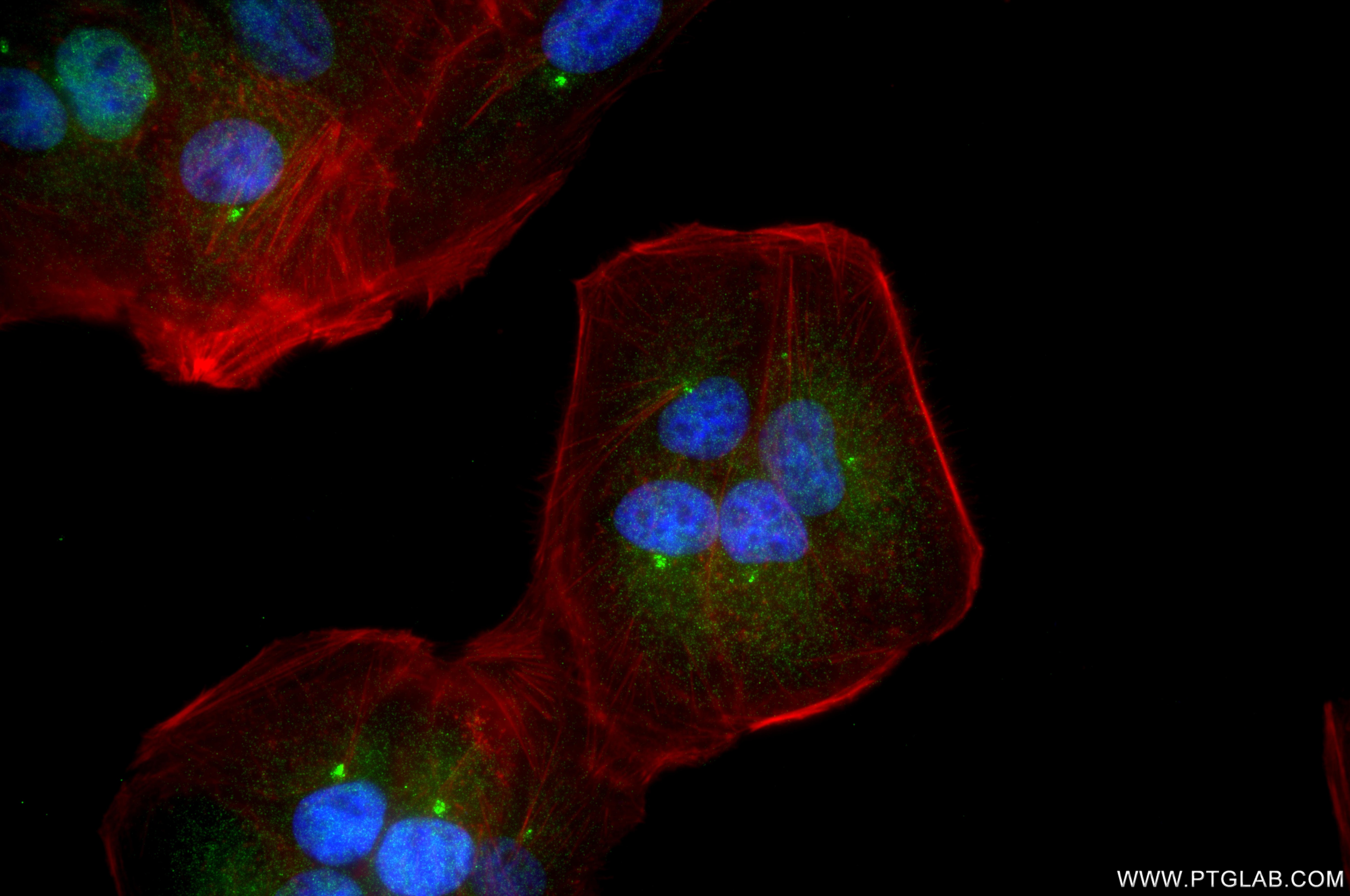 Immunofluorescence (IF) / fluorescent staining of hTERT-RPE1 cells using CP110 Recombinant monoclonal antibody (80965-6-RR)