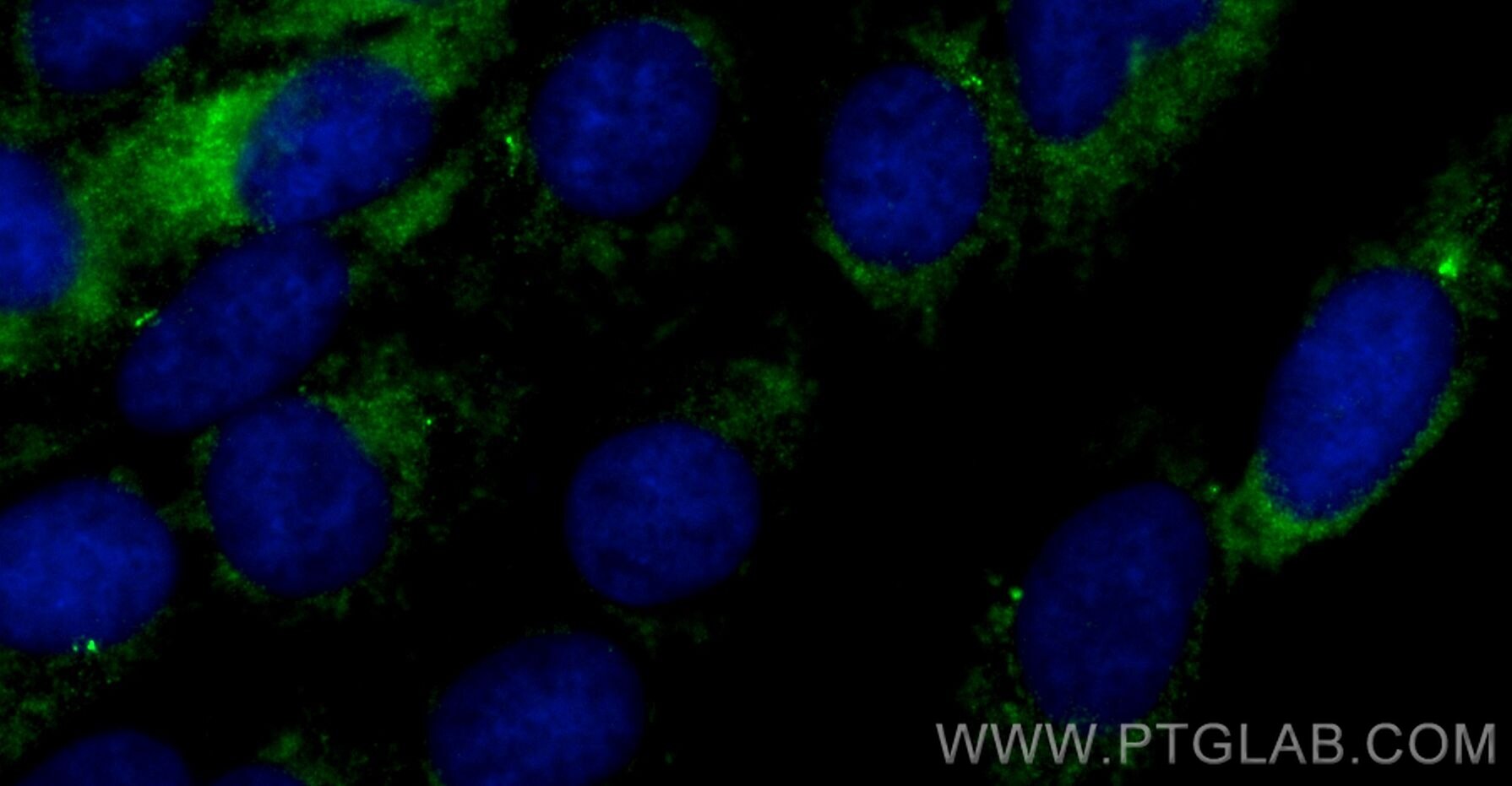 Immunofluorescence (IF) / fluorescent staining of hTERT-RPE1 cells using CoraLite® Plus 488-conjugated CP110 Polyclonal ant (CL488-12780)