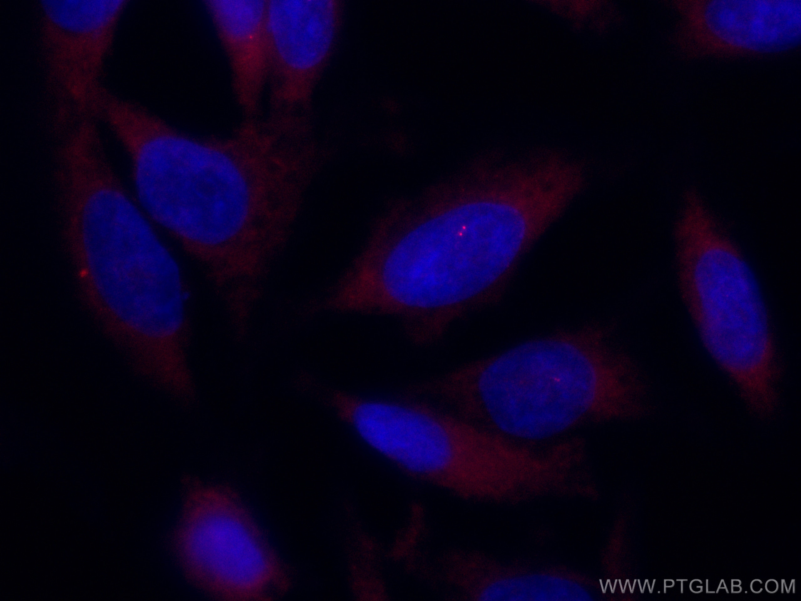 Immunofluorescence (IF) / fluorescent staining of HeLa cells using CoraLite®594-conjugated CP110 Polyclonal antibody (CL594-12780)