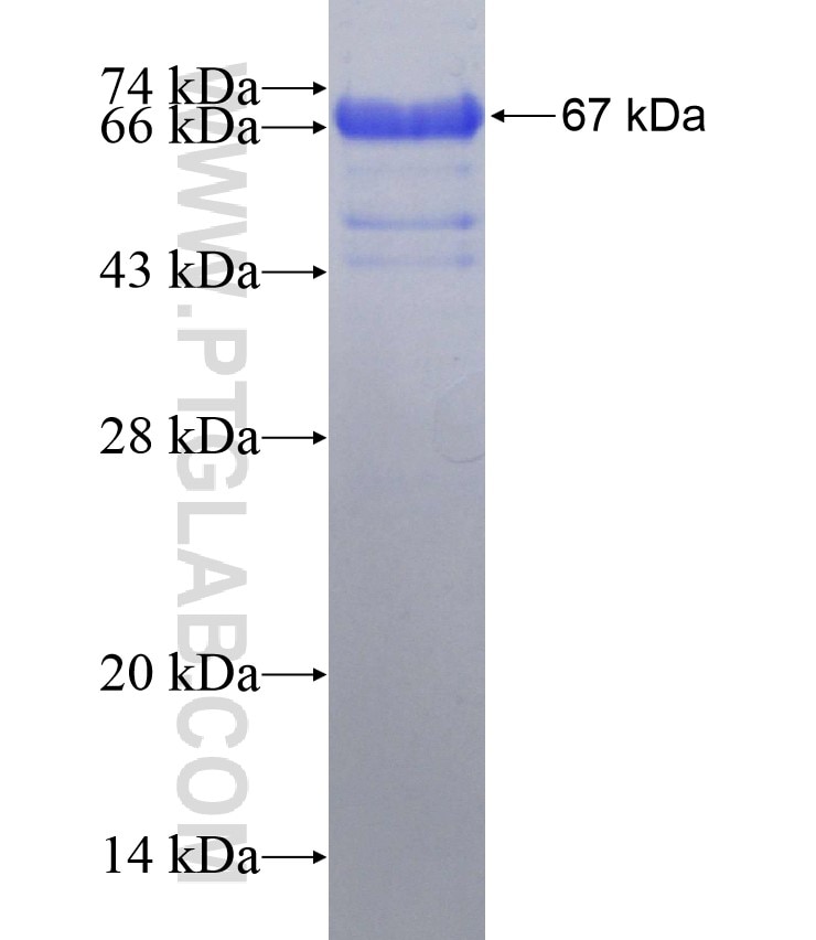 CP110 fusion protein Ag3489 SDS-PAGE