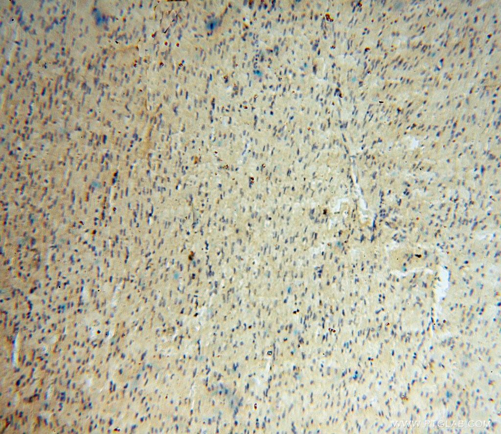 Carboxypeptidase A1