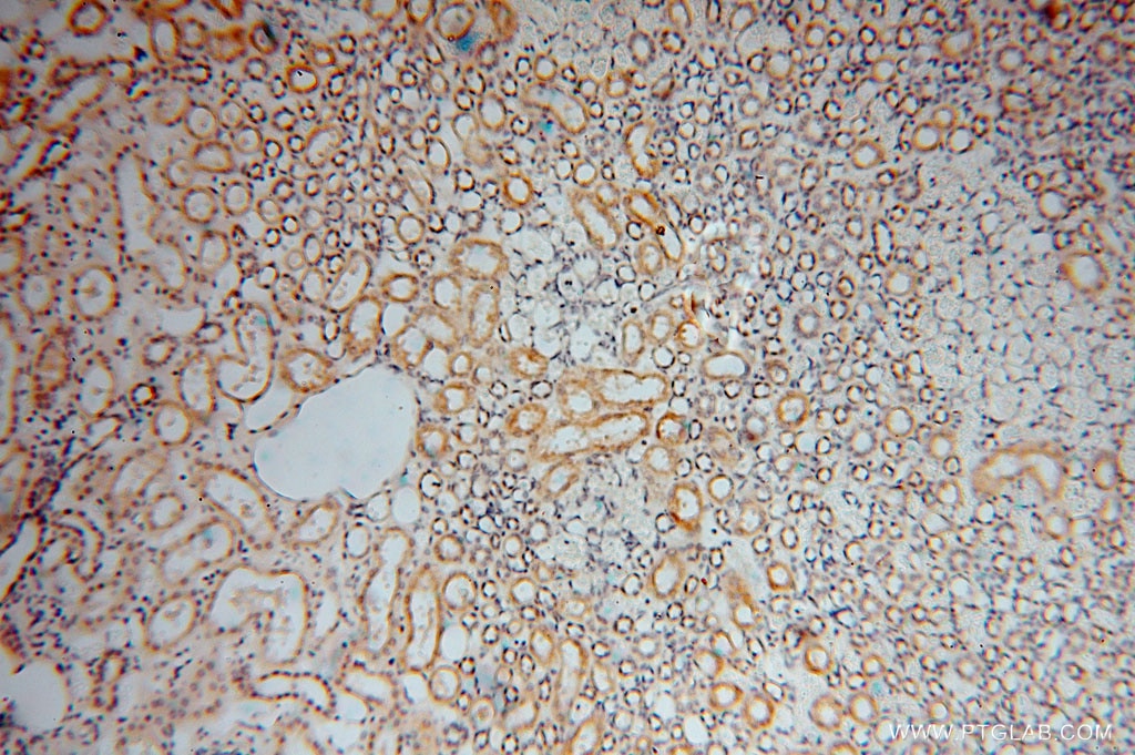 Immunohistochemistry (IHC) staining of human kidney tissue using Carboxypeptidase A1 Polyclonal antibody (15836-1-AP)