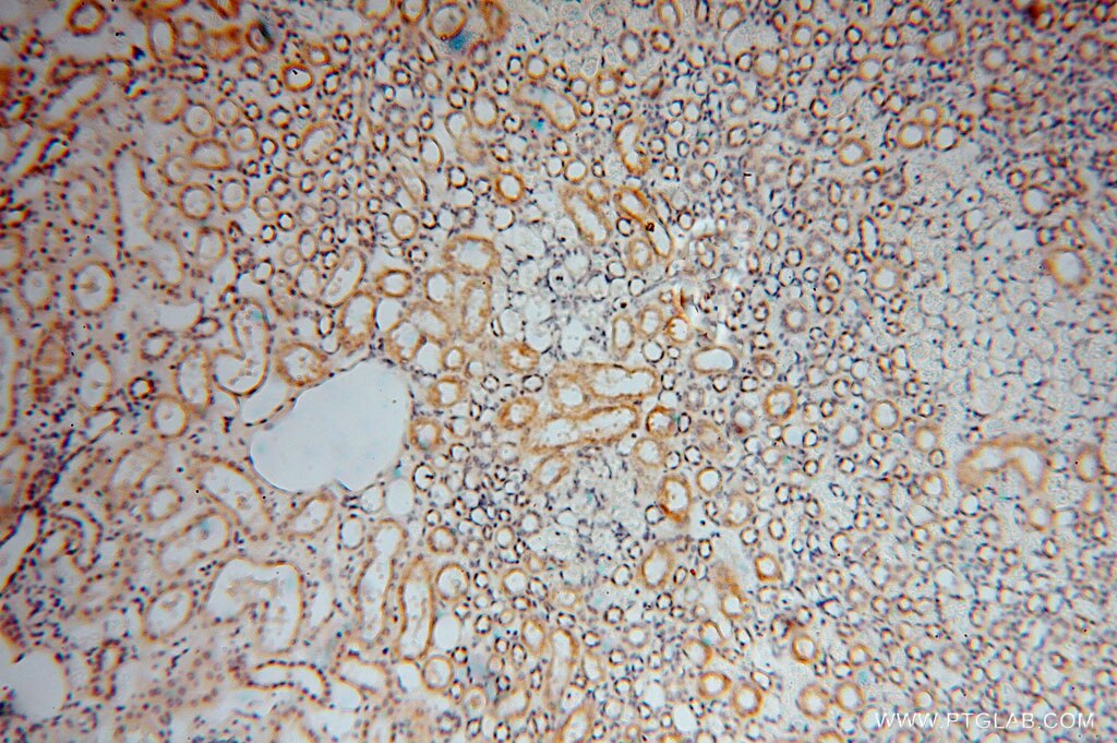 Immunohistochemistry (IHC) staining of human kidney tissue using Carboxypeptidase A1 Polyclonal antibody (15836-1-AP)