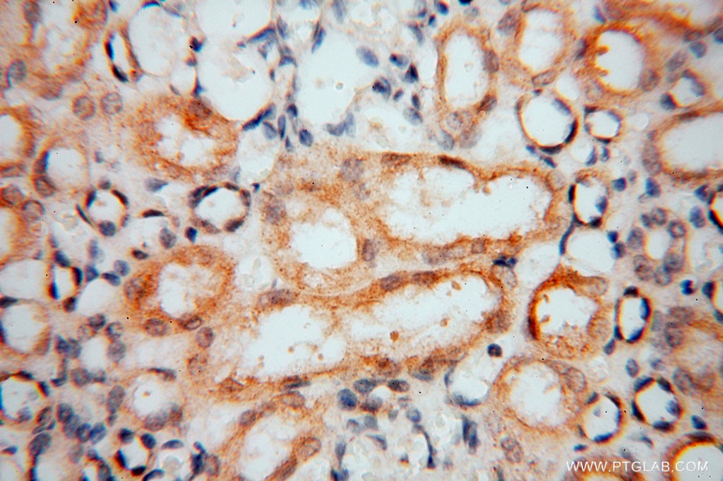 Immunohistochemistry (IHC) staining of human kidney tissue using Carboxypeptidase A1 Polyclonal antibody (15836-1-AP)