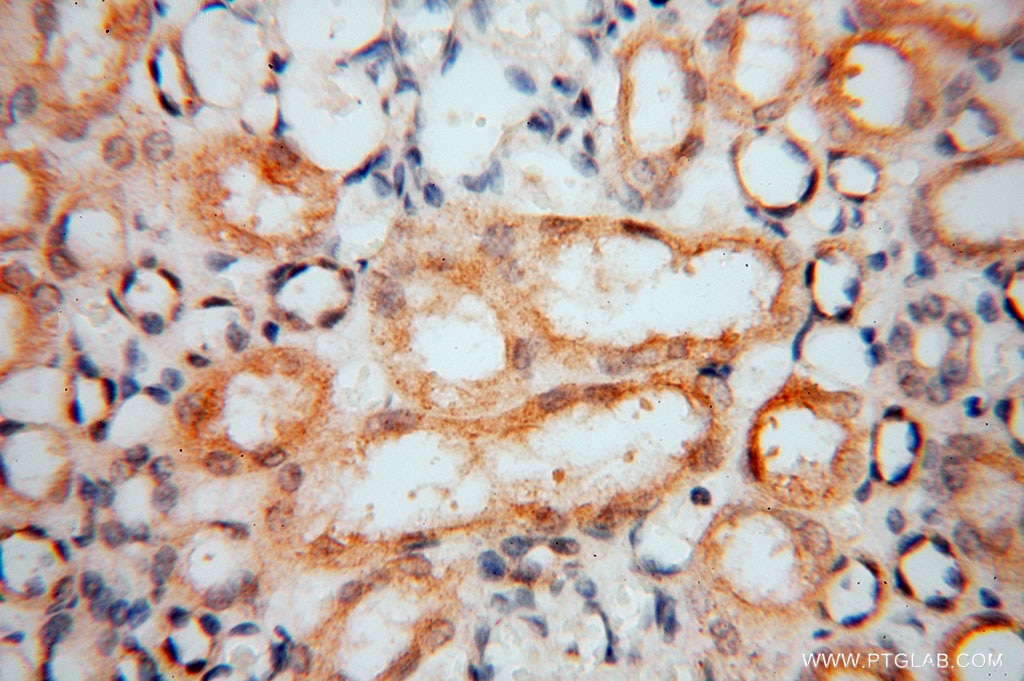 IHC staining of human kidney using 15836-1-AP