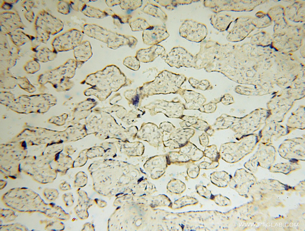 IHC staining of human placenta using 15836-1-AP