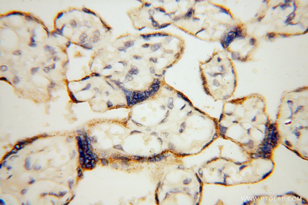 Immunohistochemistry (IHC) staining of human placenta tissue using Carboxypeptidase A1 Polyclonal antibody (15836-1-AP)
