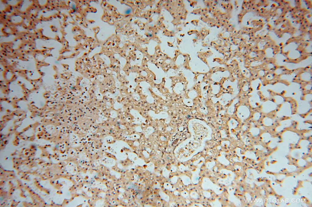 Immunohistochemistry (IHC) staining of human liver tissue using Carboxypeptidase A1 Polyclonal antibody (15836-1-AP)