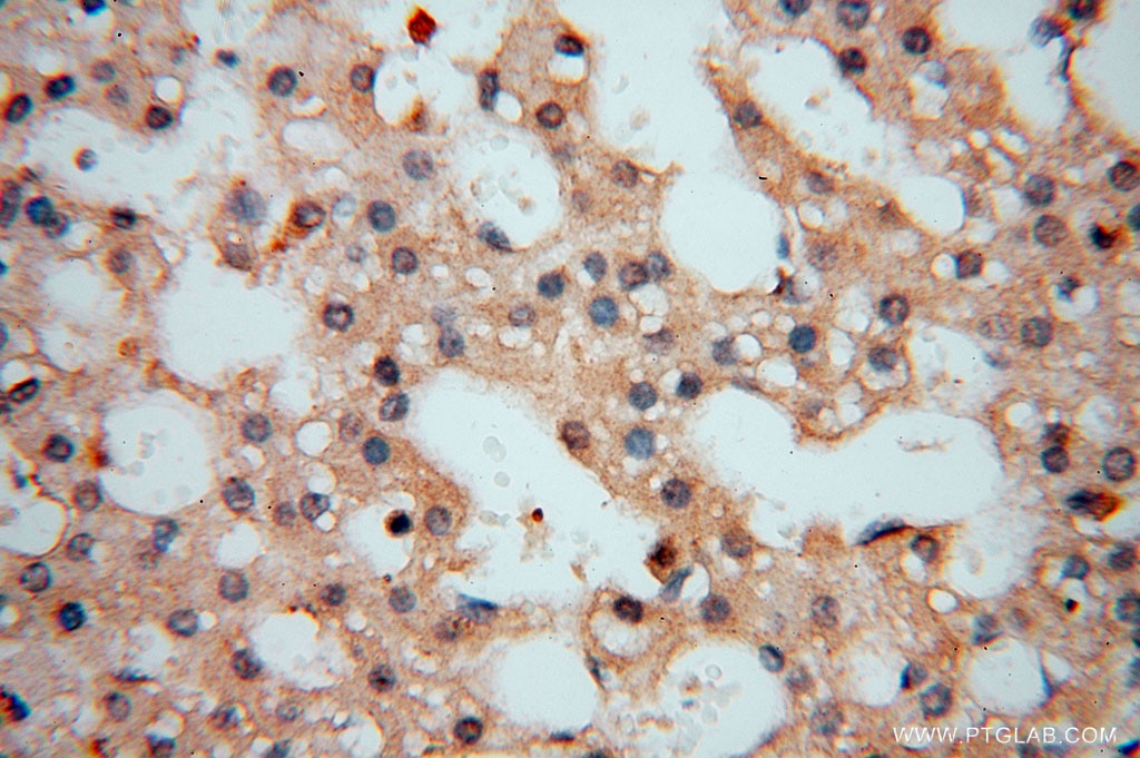 Immunohistochemistry (IHC) staining of human liver tissue using Carboxypeptidase A1 Polyclonal antibody (15836-1-AP)