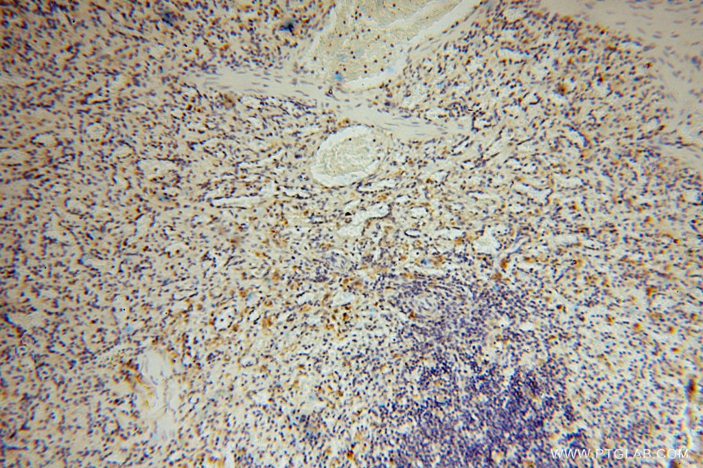 Immunohistochemistry (IHC) staining of human spleen tissue using Carboxypeptidase A1 Polyclonal antibody (15836-1-AP)