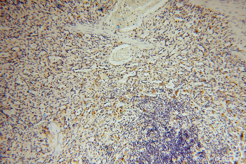 IHC staining of human spleen using 15836-1-AP